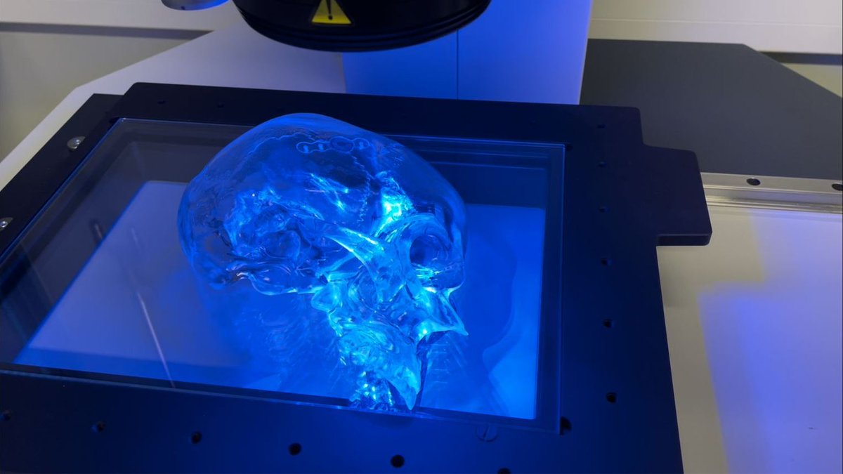 Tällainen on Tampereella tutkittu kehoon asennettava älyimplantti, joka katoaa jäljettömiin
mtvuutiset.fi/artikkeli/tall…