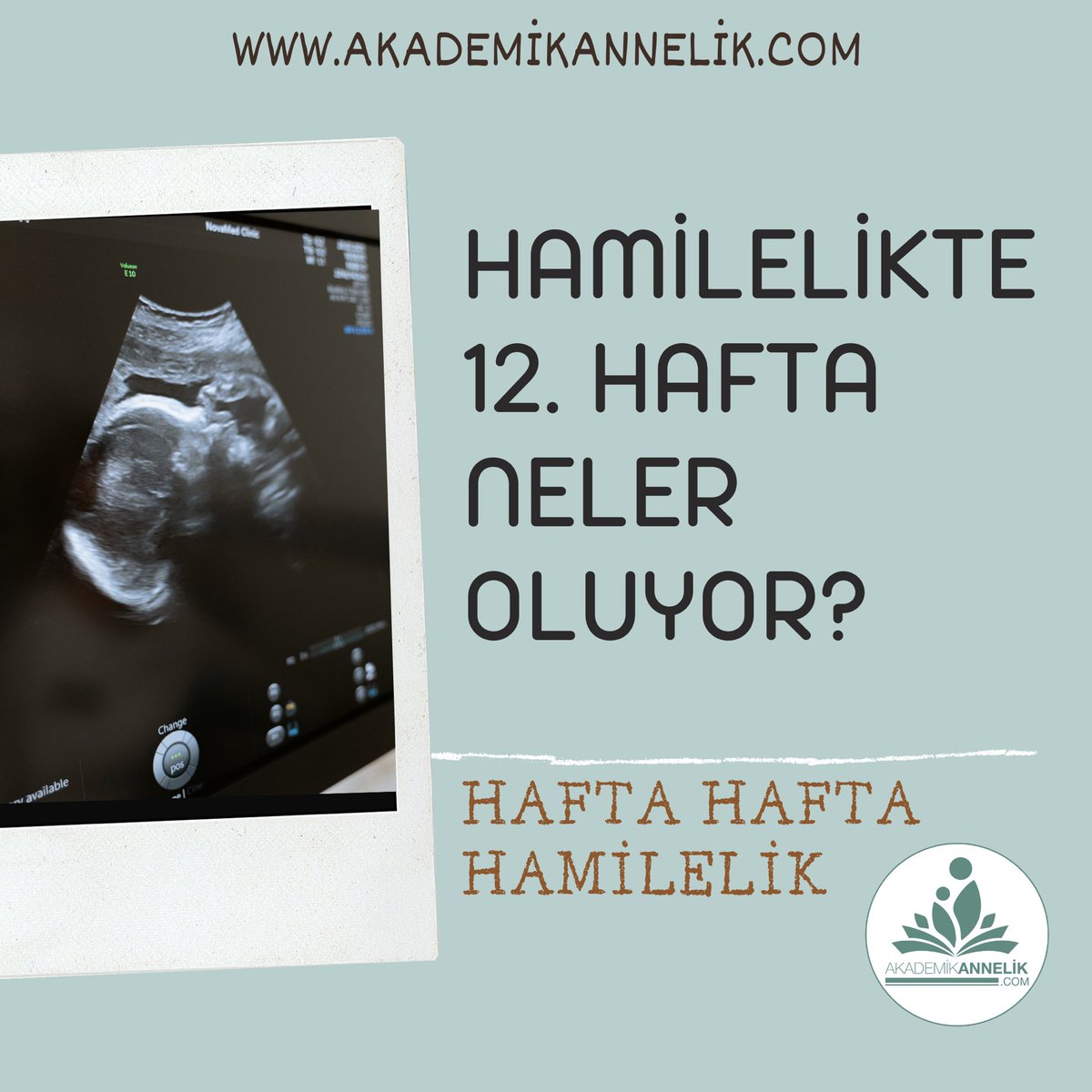 12 HAFTA HAMİLELİK- HAFTA HAFTA HAMİLELİK

Ayrıntılı bilgi için tıklayın: akademikannelik.com/Hafta-Hafta-Ha…

#12weeks #12haftalıkhamilelik #12weekspregnant #pregnancy #pregnant #PregnantWoman #pregnantlady #SaturdayVibes #SaturdayMotivation #saturday #hamilelik