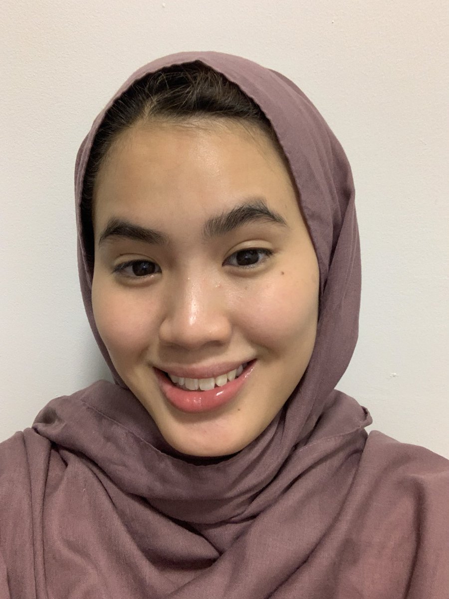 najihahshahrel's tweet photo. Sebab product ni ada sales, so I nak share my INSTANT GLOWING skincare hack/tips.

Dengan modal RM7.88, I boleh dapat skin glowing dalam masa 10 mins hehe. 

Before vs after. 

Yang After tu nampak lebih fresh, glowing, well-hydrated and ready to get married cewah. https://t.co/5nMo2auq3j