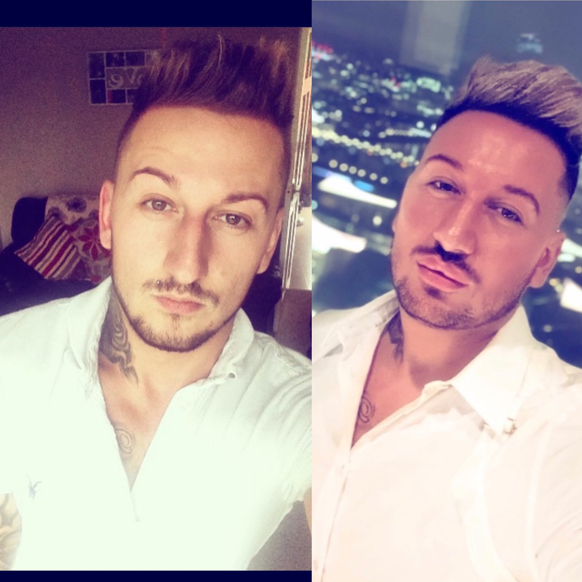 AR_S1990's tweet photo. A nose job, some filler, Botox and 6 years later…. https://t.co/BsR4a5SDRb