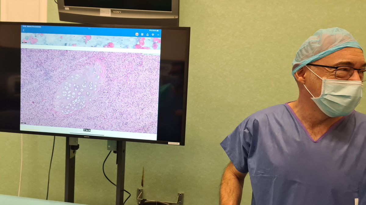 edusqo's tweet photo. With a great colleague from Granada, Dr. López Hidalgo @JavierLuisLpez4, showing me some interesting #EBUS cases... Lara's lesion @lara_pijuan, is a classic!!! 
#EBUSTwitter #CytoPath #PulmPath #SESSEP21 https://t.co/dxN33qiVma