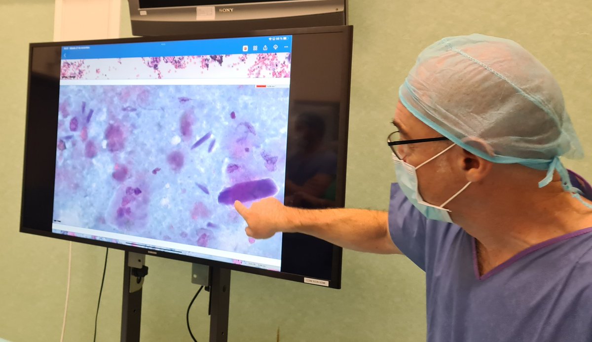edusqo's tweet photo. With a great colleague from Granada, Dr. López Hidalgo @JavierLuisLpez4, showing me some interesting #EBUS cases... Lara's lesion @lara_pijuan, is a classic!!! 
#EBUSTwitter #CytoPath #PulmPath #SESSEP21 https://t.co/dxN33qiVma