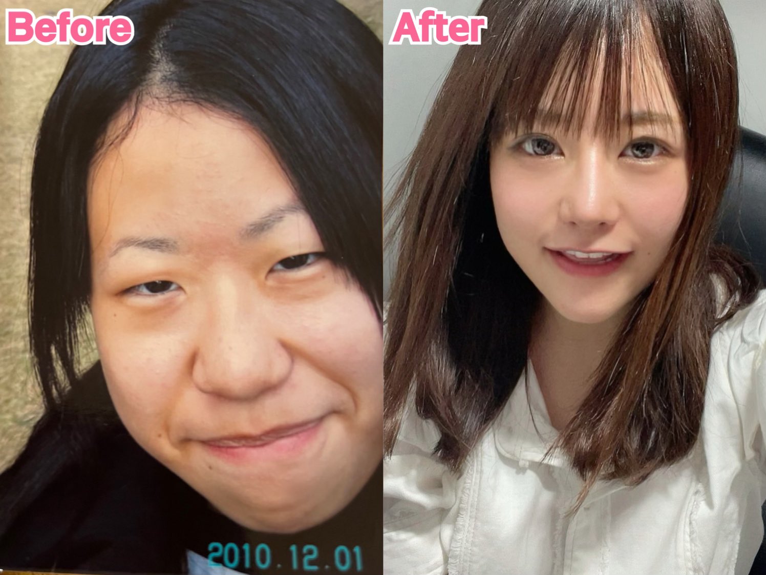 ゆう 美容整形の割引 交際倶楽部 Clinic Navi Twitter