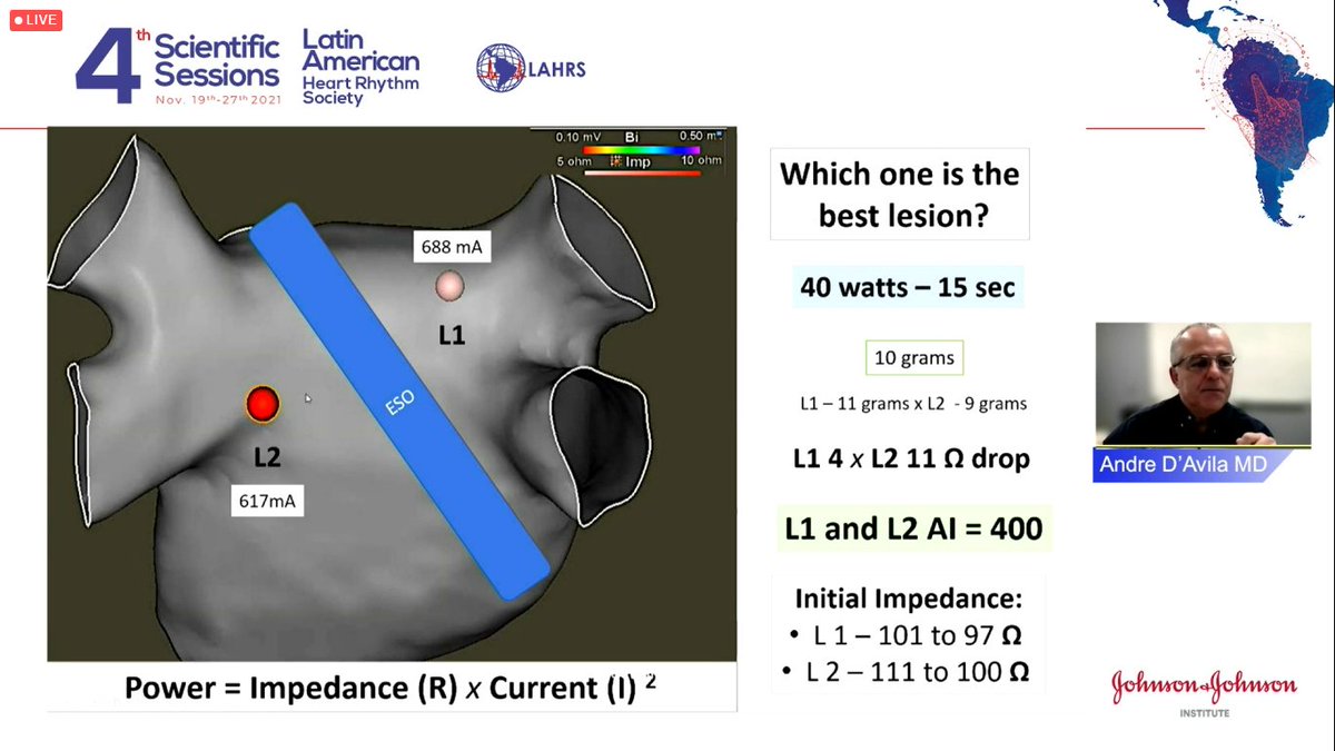 figueiredo_ep's tweet photo. Live at #LAHRS2021 https://t.co/HoChAzbpZD