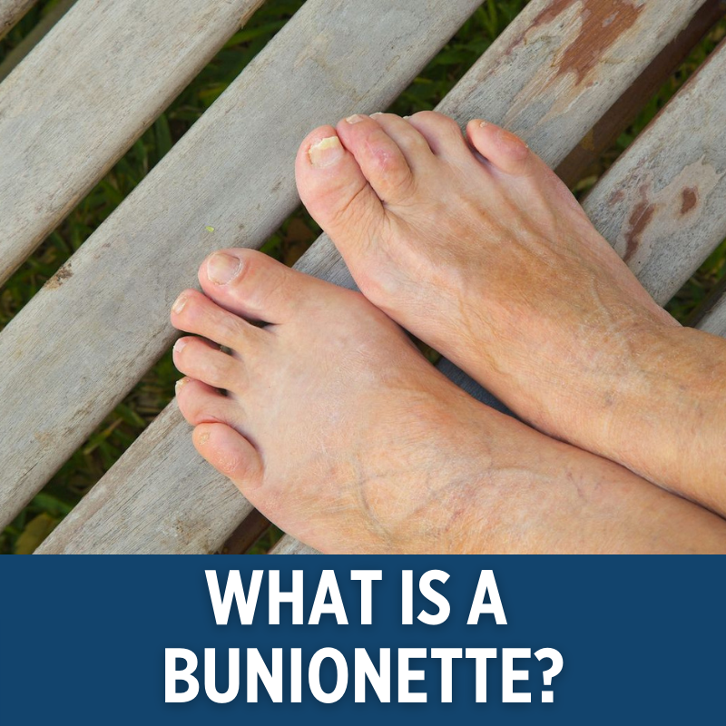 River_Podiatry's tweet photo. Our Dr. Jungwoo shares his insight on a bunionette, what causes it and how to treat this foot issue. Click the link below to learn more. 

https://t.co/D3RY6kyP5l https://t.co/gZAomnKwrZ