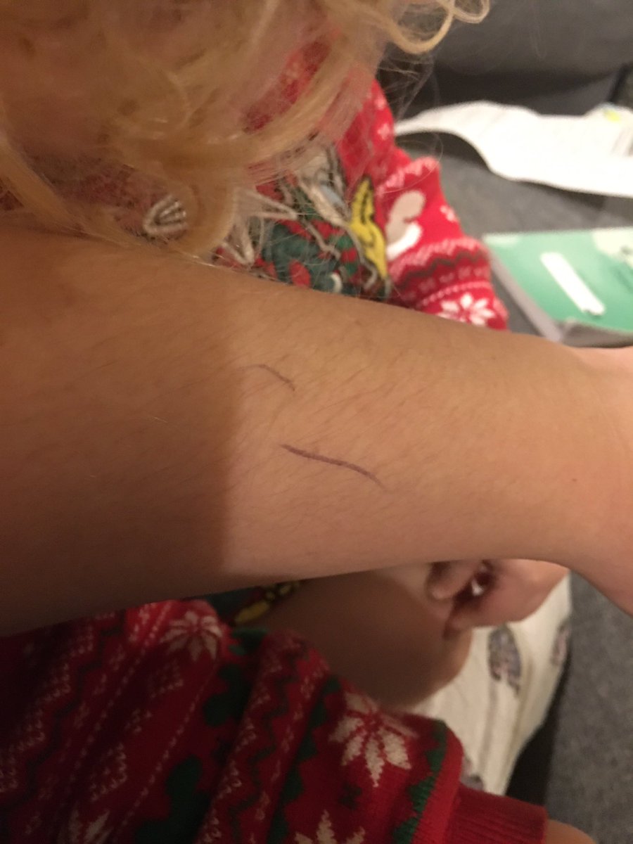 howlett_leanne's tweet photo. Working our way through the 2 yr review paperwork and now everything that it’s possible to draw on has a line on it 🤣🤣 #infantdevelopment #ASQ3 #26monthold https://t.co/W2MwYot8sh