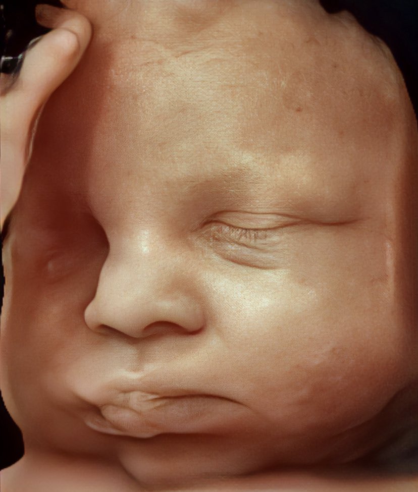 EstelaMiloS's tweet photo. Fetal love #prenataldiagnosis #obstetrician #fetalmedicine #fetality https://t.co/4J1sQAM0ng