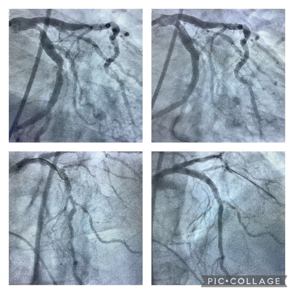 Rodrigo V. Wainstein, MD, PhD tweet media