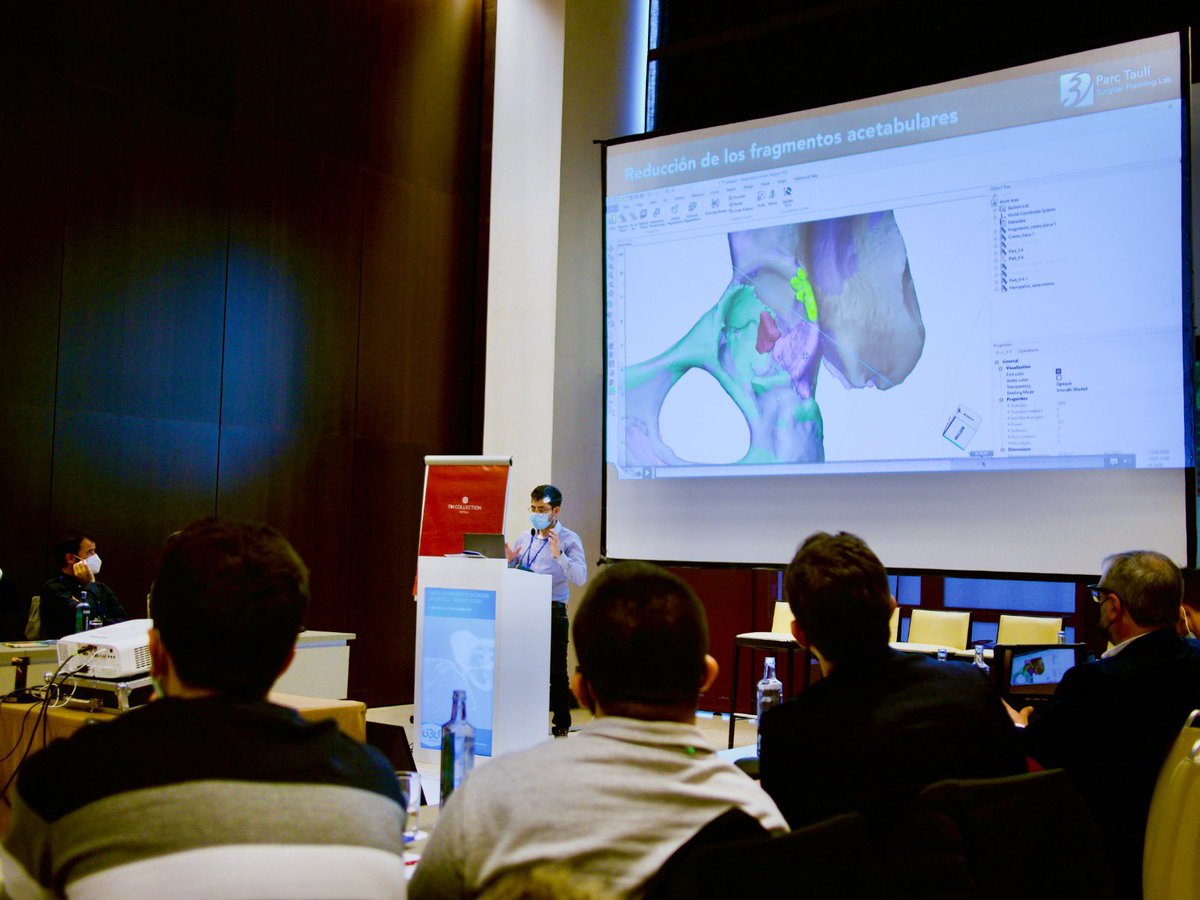Trauma3D's tweet photo. 📢 Finaliza el 6️⃣ curso de #impresión3d en Cirugía Ortopédica y Traumatología.
🆒 Ha sido un curso innovador que ha unido a traumatólogos, radiólogos y bioingenieros, con un interés común en implementar la tecnología #3d en hospitales.
🌟 Iremos actualizando con más info! #3DCOT https://t.co/Wz7zDhBznk
