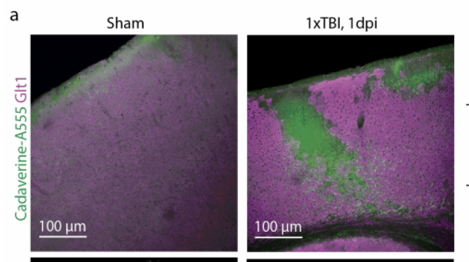 J_Neurotrauma's tweet photo. @Robel_Lab's new paper describes how mild #TBI / #concusssion initiates an atypical #astrocyte response caused by blood-brain barrier dysfunction following
@StefanieRobel work finds BBB leakage and atypical astrocytes months after the TBI.
https://t.co/xUUXnxZQ3S https://t.co/0XK1daau2c