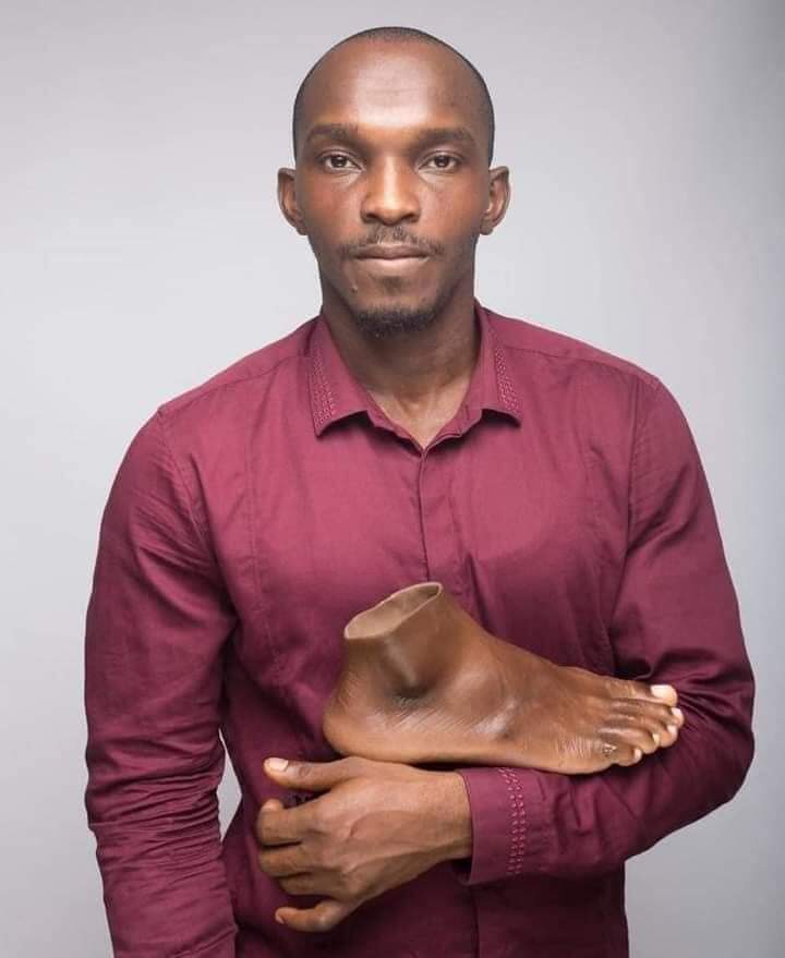 ivantresor67's tweet photo. ⭕Nigeria
UN NIGERIAN CONÇOIT DES PROTHÈSES HYPERREALISTES ADAPTÉES À LA COULEUR DE LA PEAU NOIRE John Amanam, est un nigérian de 33 ans et ancien ingénieur en effets spéciaux.Depuis un an, il a mis sur le marché sa marque IMMORTAL COSMETIC ART. Il fabrique des prothèses https://t.co/Os8t2j2spQ
