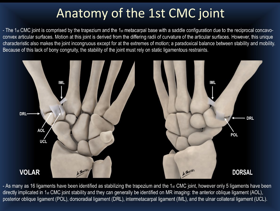 dflemosmd's tweet photo. (1/4) As requested by multiple Twitter peeps…here we go with more slides (I’ll post 16 of 35) of our #RSNA21 exhibit: 
👍“Thumbs Up Or Down? 👎 
MRI of 1st CMC Joint Arthroplasty” 
#MSKRad #orthotwitter #radres @ssr_rwg @SSRbone @intskeletal @ESSRmsk @MskSerme @ocad_msk https://t.co/Cyg6sUWqPm
