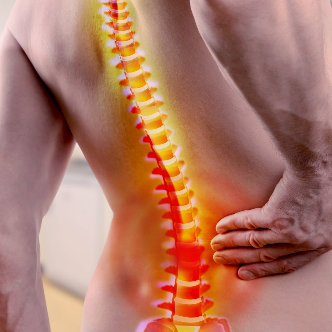 drcevincormier's tweet photo. Supporting Spinal Health-
You've only got one spine. Take great care of it with supportive chiropractic care. 
Call us to schedule your appointment 251-343-9990.
#cormierchiro #chiropractic #physicaltherapy https://t.co/9OdX7Ke4bf