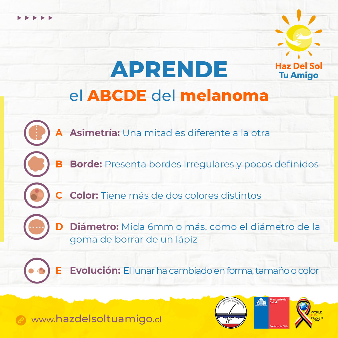Sochidermv's tweet photo. Este es el ABCDE de los lunares que debes saber para detectar melanomas y prevenir un futuro cáncer de piel. ☝

Guarda este post para que lo recuerdes, comparte con tus cercanos y dale me gusta ❤

#cáncerdepiel #rayosuv #dañosolar #hazdelsoltuamigo https://t.co/9IZjY0cDD4