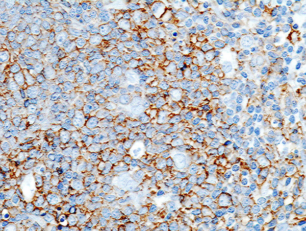 celltherapynews's tweet photo. 🗞️@CRISPRTX announced that the FDA granted Regenerative Medicine Advanced Therapy designation to CTX110™, its wholly-owned allogeneic CAR-T cell therapy targeting CD19+ B-cell malignancies.

https://t.co/WmFnAeEIJf https://t.co/lNbxgFTmp8