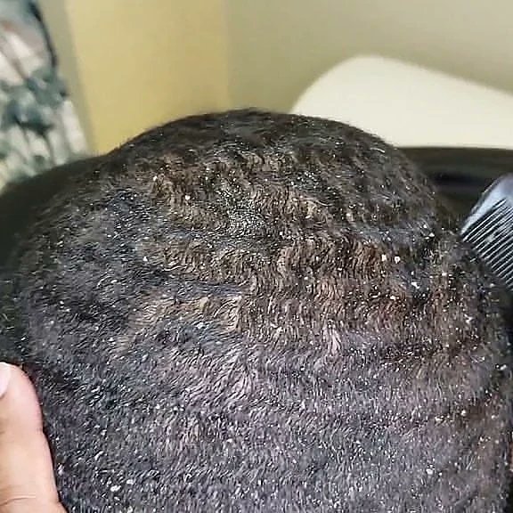 DermaSolutiongh's tweet photo. Anti-dandruff hair cream 

Treats dandruff and all scalp psoriasis

💯 effective

Now Ghs 30 ✅

DM or Call 0205773069 

Kindly Retweet 🙏 

#Dermasolution 
Peggy Oppong https://t.co/QQFWbOHpaa