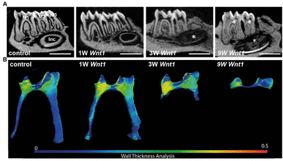 Tooth Morphogenesis and Differentiation tweet media