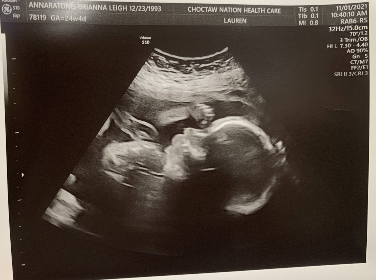 Brillebrand's tweet photo. Happy Birthday to my bb 💕 you’re gonna be an amazing dad to our son! I hope you have a great day! https://t.co/FG850Vmgm2
