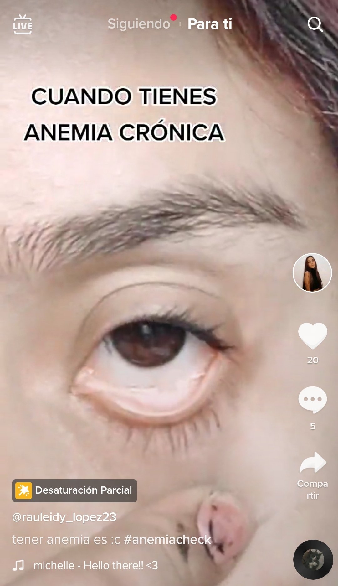 DementJG on Twitter: "Y la nueva moda en tik tok es un filtro para pretender tener anemia, es que ya saben que inventar para conseguir like por lastima. https://t.co/JfcRjPVQjS"