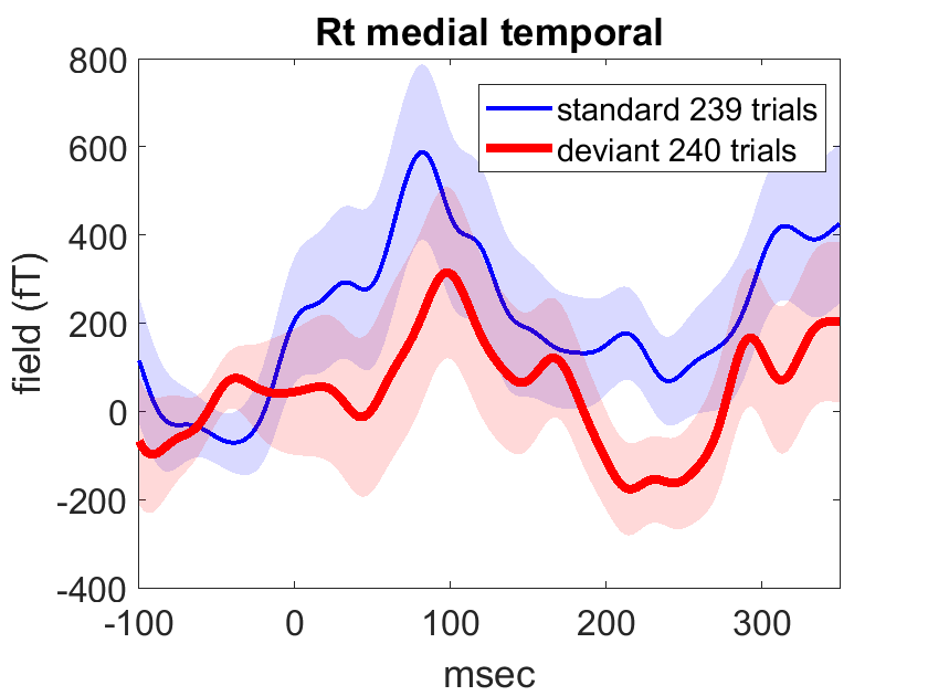 MartaIGarrido's tweet photo. And wait for it.... a gorgeous #MMN #predictionerror 😍🤓🤩 https://t.co/qzsGYKBY6R