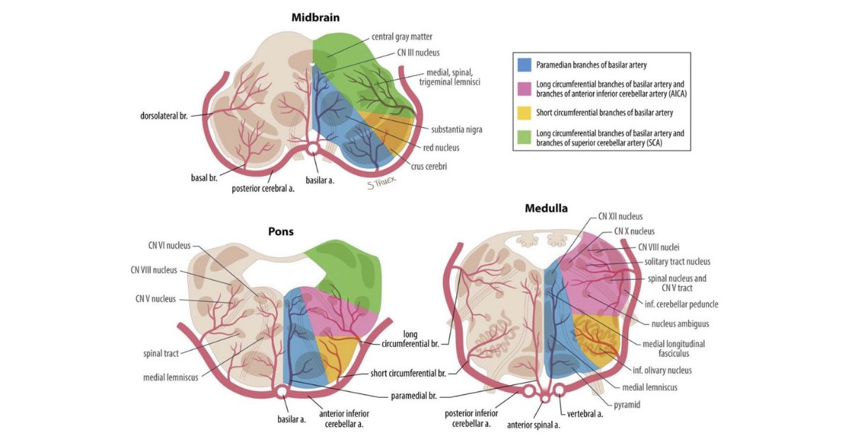 Novakovic-White et al provide a literature review of clinical, radiographic and anatomical features of posterior circulation ischemia and systematic review of the literature on the management of basilar artery occlusion and associated outcomes. bit.ly/3FGHlRU #Neurology