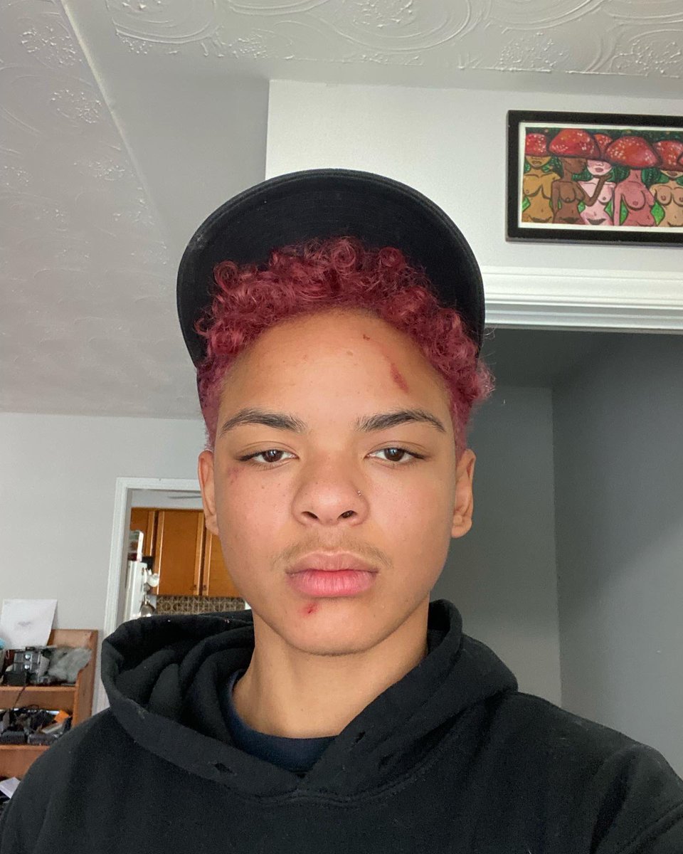EzraAfterr's tweet photo. TW; Assault, Blood
On Nov 26th I was violently arrested, misgendered and assaulted by @HamiltonPolice After showing up to support my friends and family advocating for houseless people in Hamilton. Please tune into the press conference streaming from @HamOntESN tomorrow morning. https://t.co/yjYu4YSY2r