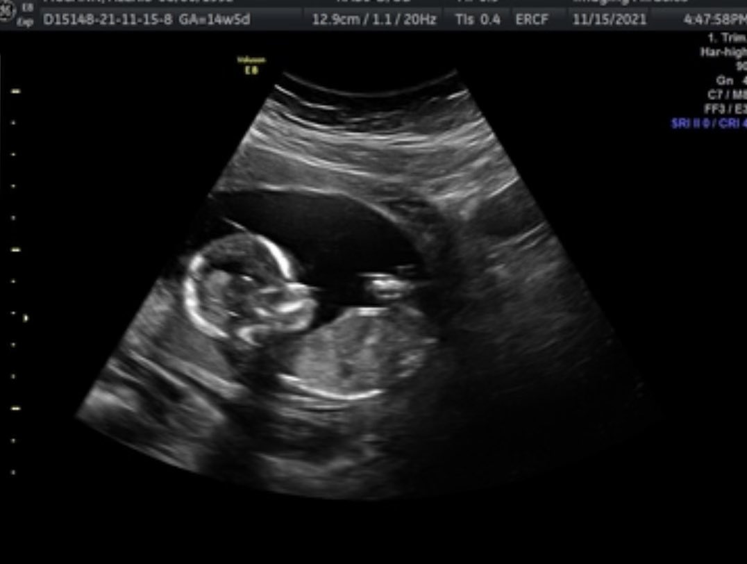TTrebb's tweet image. It’s been hard keeping this a secret from you guys because I’m so excited but…Coming May 2022 @sixeluh and I add the first edition to our family. 💜