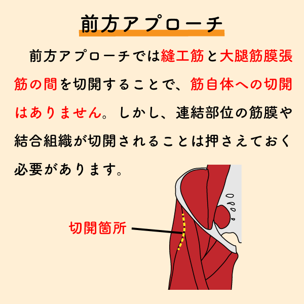 riha_note's tweet photo. THA術後のリハで着目すべき筋肉💡

これらの筋肉が切開されることが、術後疼痛や可動域制限の原因の1つとなります。
術式によっても変わるため、リハビリ担当者は主治医の確認も必ず取りましょう。 https://t.co/zSCCqDwMI1