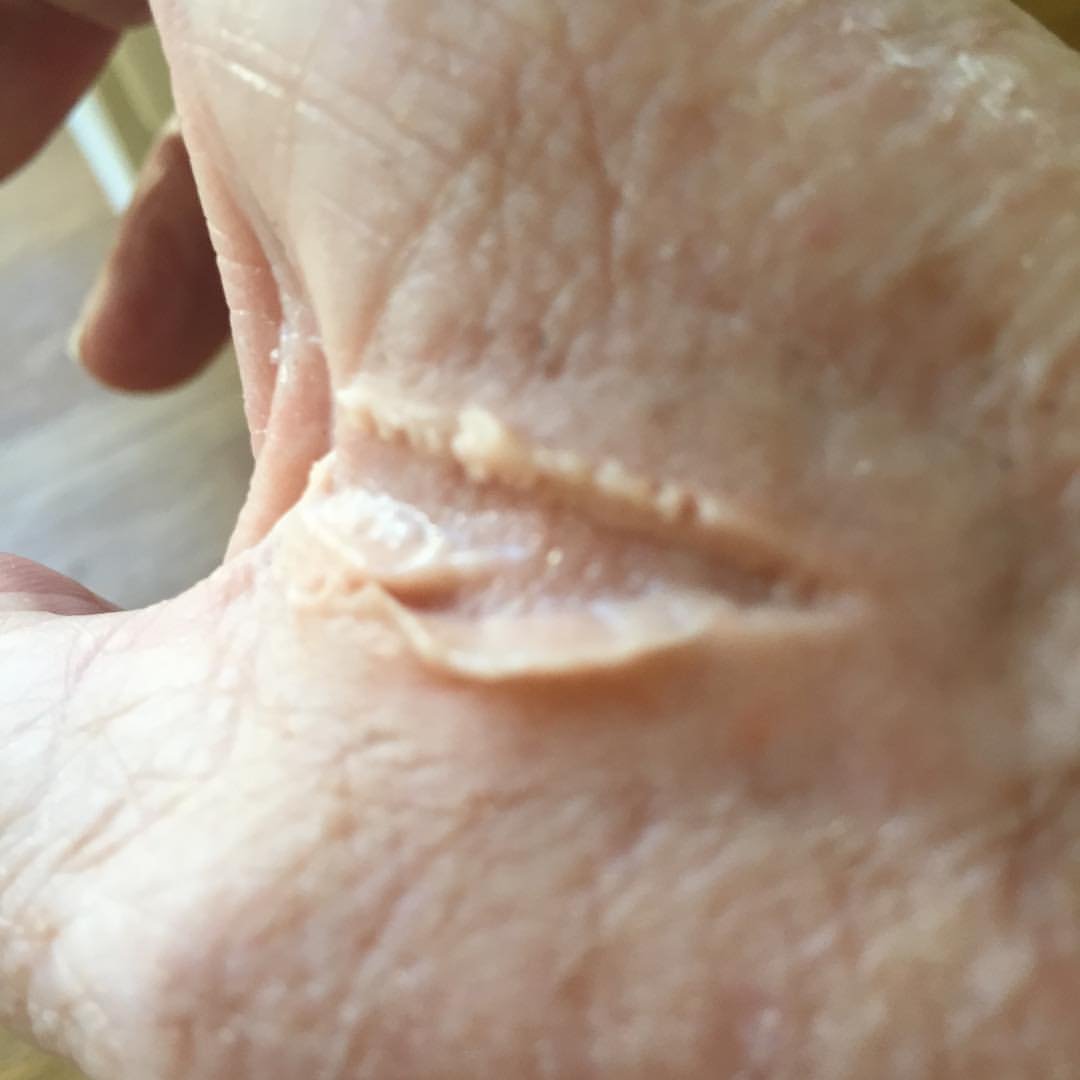 MoulageMumma's tweet photo. Part 1 -Deep laceration, pre colouring #ThankMoulageItsThursday #NotJustASimTech #MakeLearningComeToLife #SimTechsRock #SimulationRocks #MoulageRocks
@sirmanfer @AspihTechSig @HealthySim #Fake #makeup @simulationtek @BeReadyNHC @TXSIMTECH @SSHorg #SimTribe @sim_aware https://t.co/RIqkt1o3fF