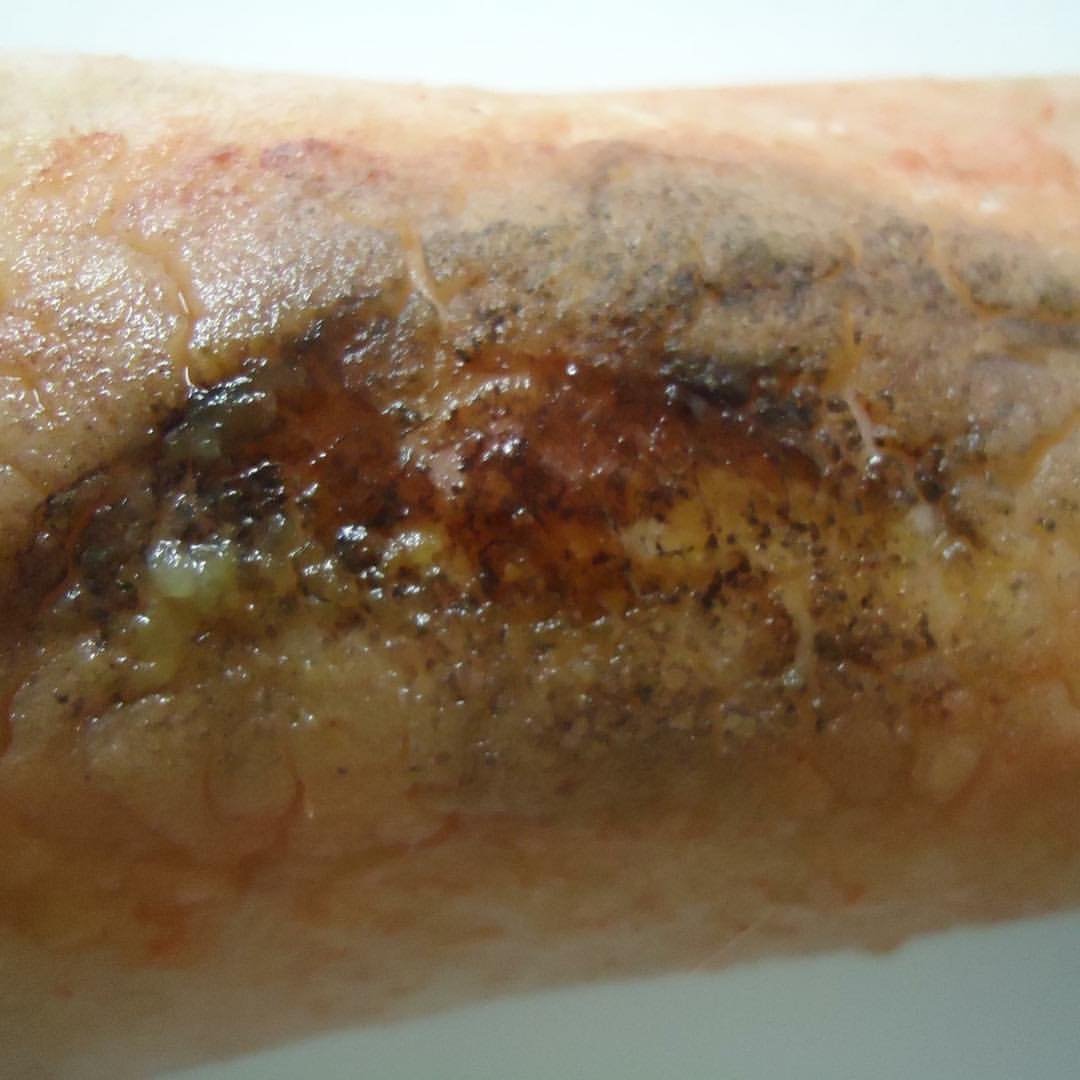 MoulageMumma's tweet photo. #WoundWednesday Simple Burn #MoulageMonday #NotJustASimTech #MakeLearningComeToLife #SimTechsRock #SimulationRocks #MoulageRocks 
@sirmanfer @ASPiHUK
@AspihTechSig @HealthySim #Fake #makeup 
@simulationtek @BeReadyNHC @TXSIMTECH
@SSHorg #SimTribe @sim_aware https://t.co/JoaEK6y7Is