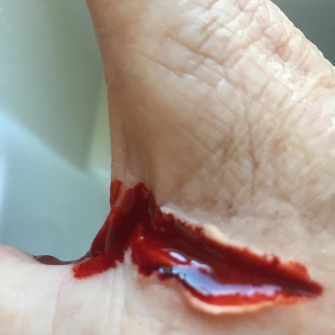 MoulageMumma's tweet photo. Part 2 -Deep laceration, coloured #ThankMoulageItsThursday #NotJustASimTech #MakeLearningComeToLife #SimTechsRock #SimulationRocks #MoulageRocks
@sirmanfer @AspihTechSig @HealthySim #Fake #makeup @simulationtek @BeReadyNHC @TXSIMTECH @SSHorg #SimTribe @sim_aware https://t.co/E1l2HeAXFR
