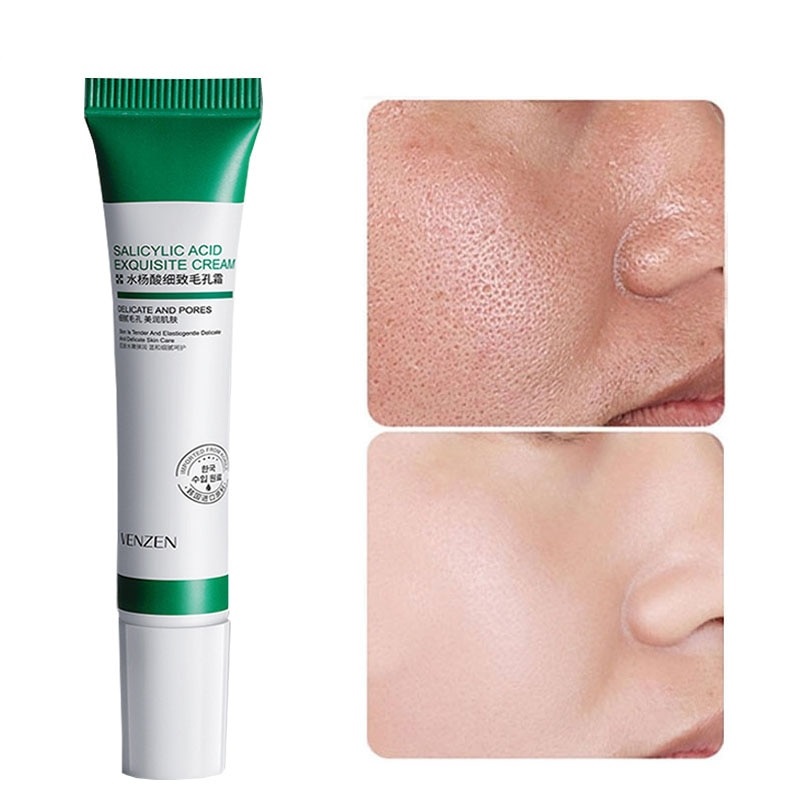 olganash987's tweet photo. Salicylic acid is a key ingredient in many skin-care products for the treatment of acne, psoriasis, calluses, corns, keratosis pilaris, and warts @powerdaysale
https://t.co/mAEM5s7fIB
#facialscrub #skincare #scrub #bodycare #skincareproducts #skin #clensing #beautiful https://t.co/Gr8a7I7vds
