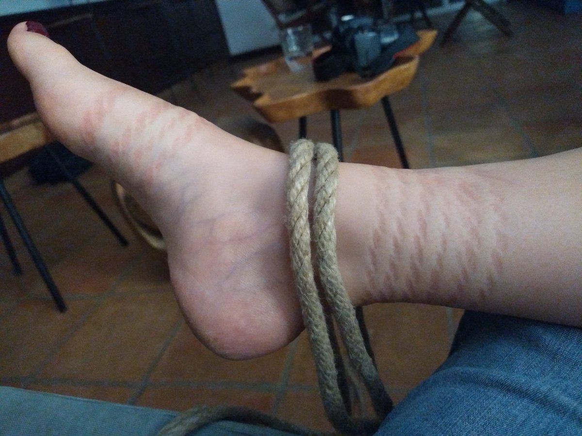 ADrssx's tweet photo. Les marques de l'amour
#bondage #shibari #footfetısh https://t.co/J9E14coWjf