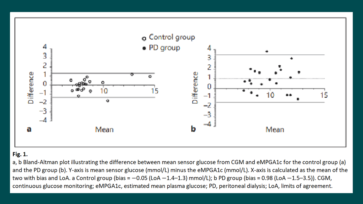 NephroKarger's tweet photo. #Hemoglobin A1c and #Fructosamine Evaluated in Patients with #Type2Diabetes Receiving #PeritonealDialysis Using Long-Term Continuous Glucose Monitoring
✍ Tobias Bomholt
📄 https://t.co/vIojpk4FCR
#️Nephron #DiabeticNephropathy #PD #CGM https://t.co/gz1MELVGFv