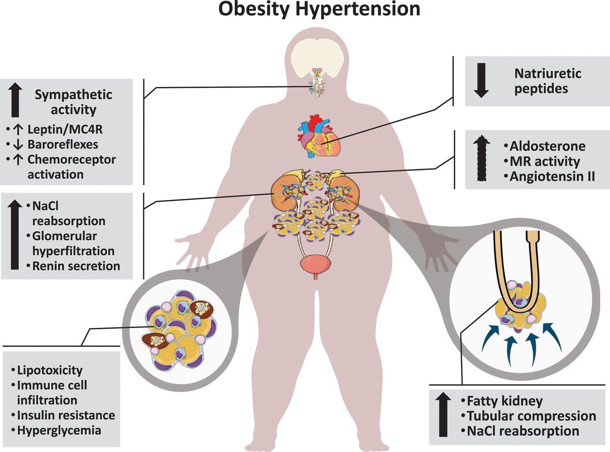 Did you get a chance to see our most recent AHA Scientific Statement: Weight-Loss Strategies for Prevention and Treatment of Hypertension? Read it today!
ow.ly/S33250GPlzp