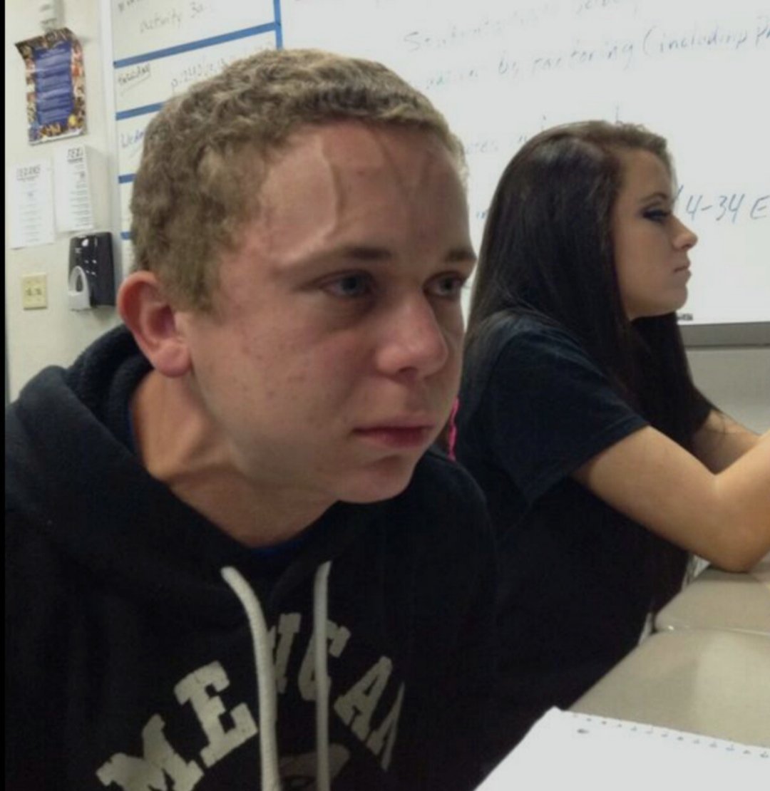 *chipaguazu con cebolla
Yo: