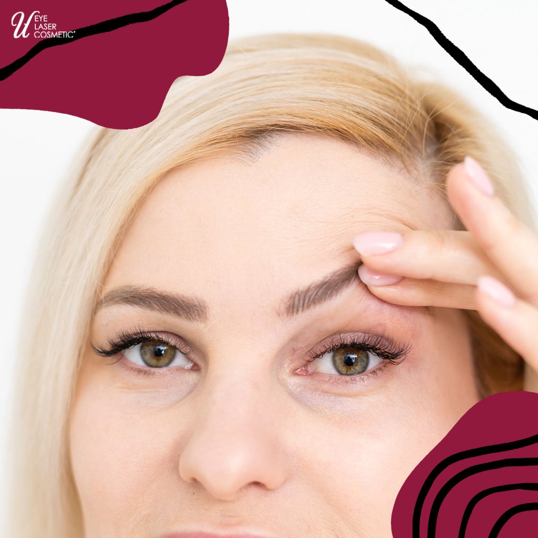 uelc_ca's tweet photo. How much of a difference can blepharoplasty (eyelid lift) make in your appearance? Check out the before and after pictures on the UELC website! https://t.co/D8uWRhhNTo #UELC #blepharoplasty #bleph #cosmeticprocedure #torontocosmeticsurgery https://t.co/fijo0Udtz4