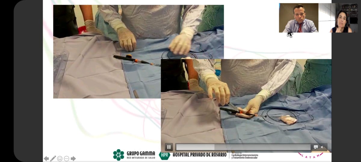 SCITE_HPR's tweet photo. Compartimos participación de @claudiocigalini en la última sesión @CliLatam 2021:
Aterectomía direccional #HawkOne | Datos clínicos y rol en la preparación del vaso
#CliFighters #CardioEd #CardioTwitter https://t.co/nO146gILSU