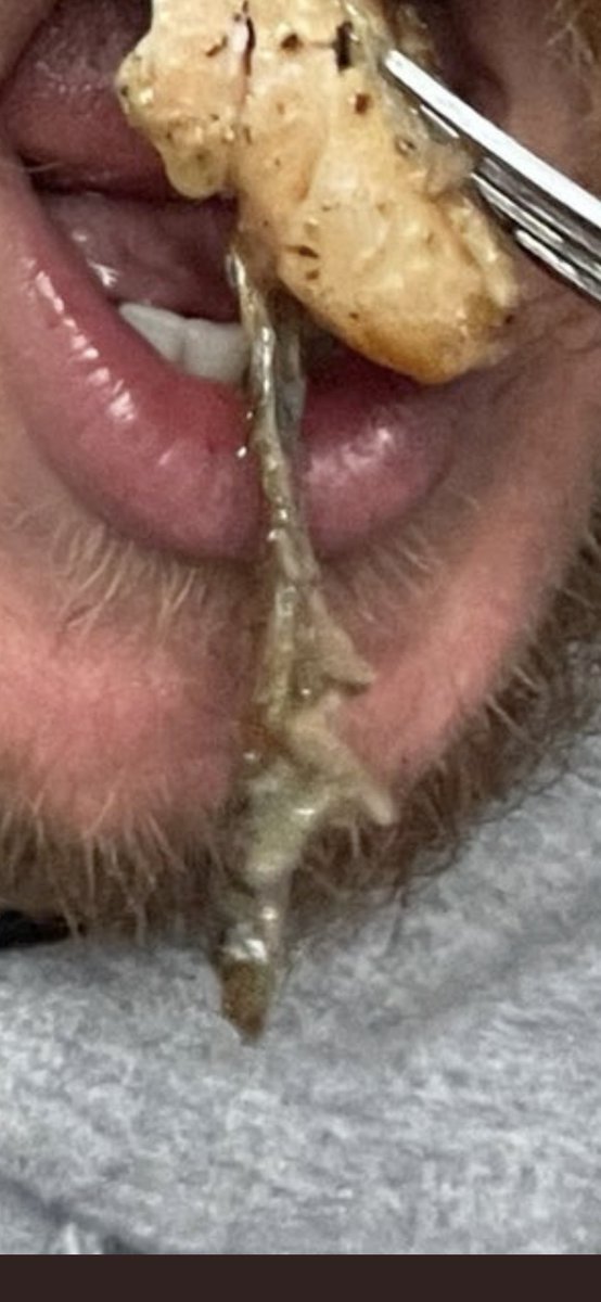 _JERM__'s tweet photo. @FeitsBarstool https://t.co/Mv0KQYFhf4