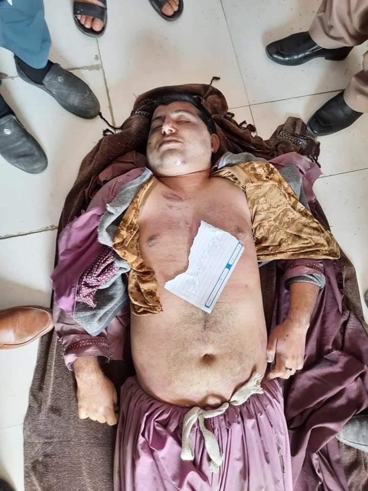 MamoonDurrani's tweet photo. This young boy was tortured and then brutally killed by the #Taliban in Southern Helmand province for a Facebook post.
His brother write down a Facebook calcification about how his bro detained and killed by local Taliban and he called for justice https://t.co/sePOx9Xt9n