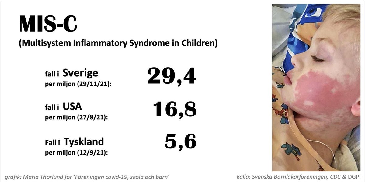 KeithMEWAS's tweet photo. In pandemic #Sweden, where the authorities @Folkhalsomynd &amp; gov unleashed a herd-immunity experiment on the people of 🇸🇪 children have been left completely unprotected &amp; exposed to the virus. 301 kids with MIS-C. Also updates on MIS-C per capita.#SparkaTegnell &amp; @Anna_Ekstrom https://t.co/bRfZ6TNIRk