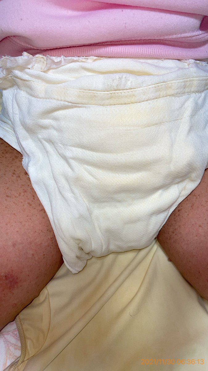 onesho2diaper's tweet photo. 日記 2021.10. 30 火 おねしょの朝
気持ちよく目が覚めた1ヶ月ぶり
起きた時おなかにおしっこが
残っている感じがなかったので
おむつに手を入れてわかった
臭いしていなかったので
朝の早い時間にもらしたのかな
おねしょの朝は気持ちいい
そういえば夜にみかんを食べたな

おむつカバーを開ける前後 https://t.co/bIi5Yrajqz