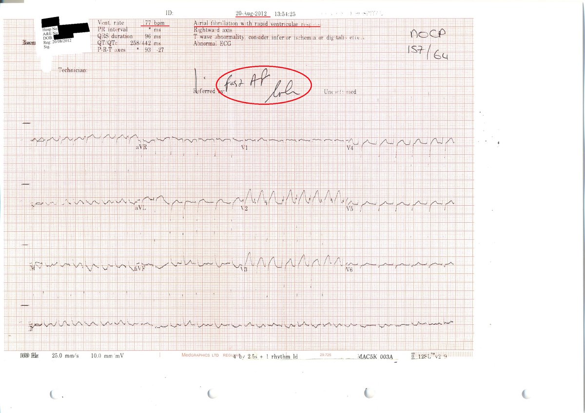 @MrMenApocalypse @CampaignNhs @charlie444b @NHSuk Diagnosis: