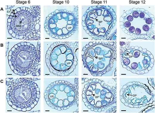 JXBot's tweet photo. Rice β-glucosidase 12BGlu38 is required for synthesis of intine cell wall and pollen fertility https://t.co/fCzx0rOjV4 
#pollen #rice #intine #cellwall https://t.co/6QC9S8bUKh