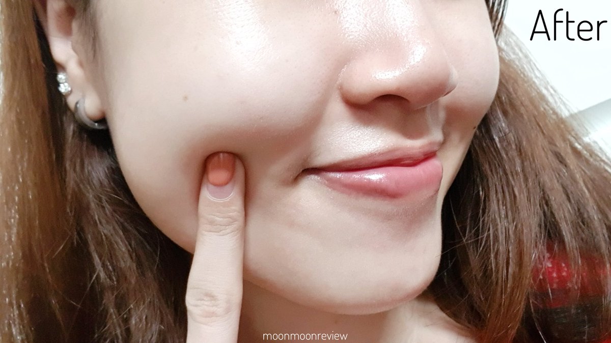 moonmoonreview's tweet photo. อยากหยิบมาป้ายยาอีกบ่อยๆ เซรั่มโอเลย์คอลลาเจน ขวดนี้อะ ด้วยเทคโนโลยีล้ำๆคอลลาเจนโมเลกุลเล็กซึมได้ลึก งานผิวเด็กต้องมา หน้าอิ่มฟู เด้ง กระชับตลอดวัน ผิวโกงอายุมากบอกเลย มันดีๆๆ #ชี้เป้าโปรถูก !! 12.12 มีโปร 599฿ ด้วยจ้า ตุนด่วนน ที่ Lazada น้า #ad #lazada1212TH https://t.co/9M9irUkni9