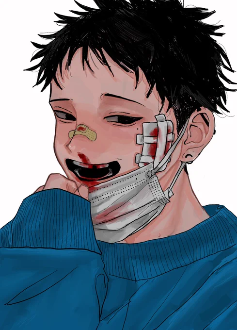 『歯折れた』 