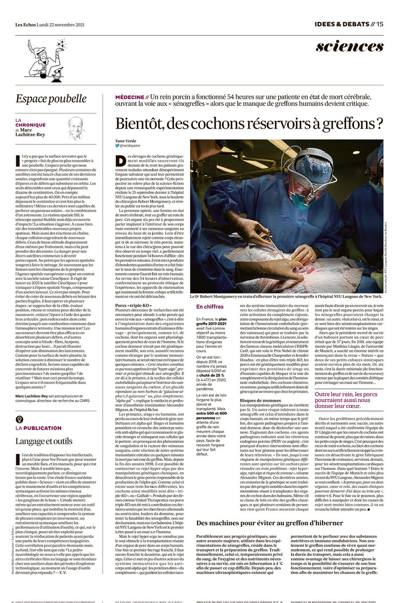 Fabrice HURÉ - Dialyse - E-Santé - SportSanté (@lmdslefilm) on Twitter photo XENOGREFFE 🙏 Article très intéressant 👌
Encore trop de #patients en attente de #greffe...
- Nouveaux #greffons
- Optimisation des #greffons
- Prédiction du #rejet (importante contribution du groupe <a href="/ParisTxGroup/">Paris Transplant Group</a> <a href="/AlexandreLoupy/">Alexandre Loupy</a>.
#transplantation #xeno
Merci A.Mignon (LinkedIn) XENOGREFFE 🙏 Article très intéressant 👌
Encore trop de #patients en attente de #greffe...
- Nouveaux #greffons
- Optimisation des #greffons
- Prédiction du #rejet (importante contribution du groupe <a href="/ParisTxGroup/">Paris Transplant Group</a> <a href="/AlexandreLoupy/">Alexandre Loupy</a>.
#transplantation #xeno
Merci A.Mignon (LinkedIn)
