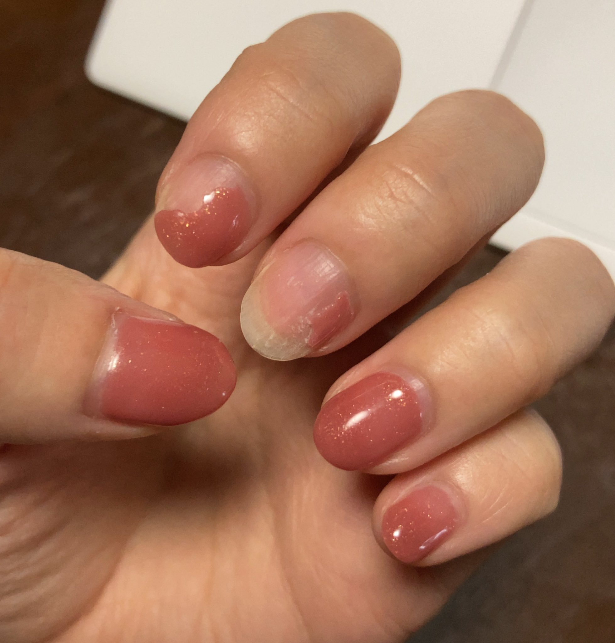 育爪観察日記 Nail Nobiiru Twitter