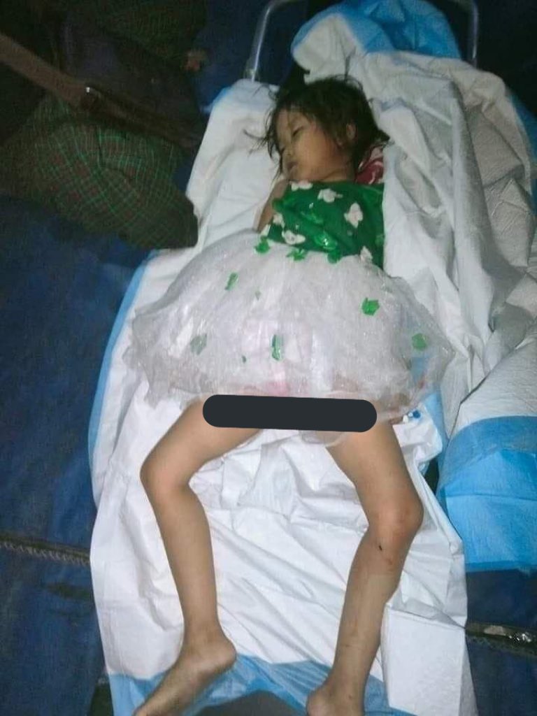 A child was brutally shot dead at her head by arbitrary shooting of vicious junta soldiers in 110th,45th*46th street, AungTharYar ward, Mandalay last night, reportedly.  #Cambodia_RejectTerrorists #Dec7Coup #WhatsHappeningInMyanmar