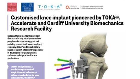 CUBiomechanics's tweet photo. Great to see our @AccelerateCIA project with @TOKAmedtech on page 62 of @mediwales LifeStories 2021 #knee #biomechanics #innovation #osteoarthritis https://t.co/CJIzBKG0fN https://t.co/7KeUPl9Iuv
